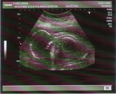 20weekscan1