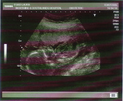 20weekscan2