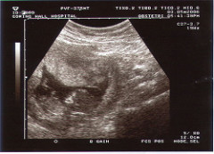 12weekscan3