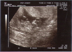 12weekscan1