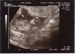12weekscan2