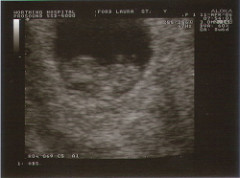 9week-Scan